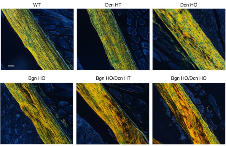 JeanJiangLab's tweet image. Exciting research from our lab! 📢 Our latest study explores the critical roles of biglycan and decorin in bone mass regulation, water retention, etc. Check it out! #BoneResearch The full text of the paper through the link: nature.com/articles/s4141…