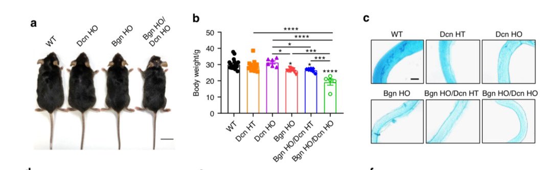 JeanJiangLab's tweet image. Exciting research from our lab! 📢 Our latest study explores the critical roles of biglycan and decorin in bone mass regulation, water retention, etc. Check it out! #BoneResearch The full text of the paper through the link: nature.com/articles/s4141…