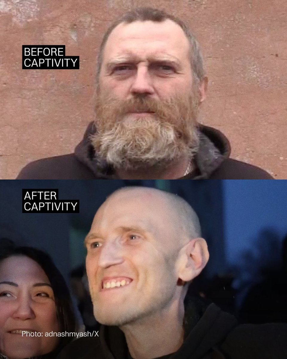 This is how Ukrainian soldier Oleksandr Kiriienko looked before he was captured by the Russians. And this is how he looks now.

He spent nearly 3 years in Russian captivity.