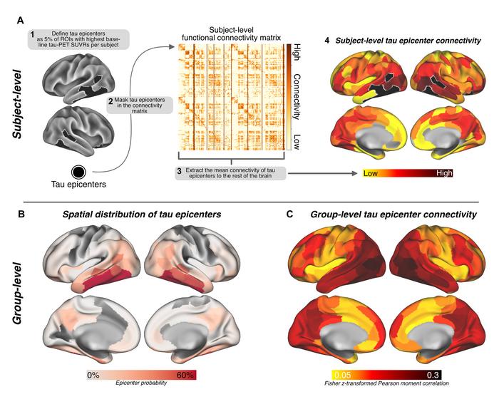 Science Magazine (@sciencemagazine) on Twitter photo What’s the relationship between #AmyloidBeta and tau protein?
New research in <a href="/ScienceTM/">Science Translational Medicine</a> involving #AlzheimersDisease patient PET and fMRI data reveals amyloid-beta may drive tau spread through hyperconnectivity between vulnerable brain regions. scim.ag/42BMCcb What’s the relationship between #AmyloidBeta and tau protein?
New research in <a href="/ScienceTM/">Science Translational Medicine</a> involving #AlzheimersDisease patient PET and fMRI data reveals amyloid-beta may drive tau spread through hyperconnectivity between vulnerable brain regions. scim.ag/42BMCcb