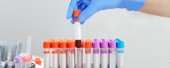 CD_AACR's tweet photo. ICYMI: "Patient-Specific Hematologic Setpoints Inform Diagnosis and Prognosis" https://t.co/D2TIsidma6
A #ResearchWatch summary of a study by @foy_brody, John M. Higgins, and colleagues @uwlabmedpath @harvardmed @MassGenBrigham https://t.co/qr2DUtkEwL