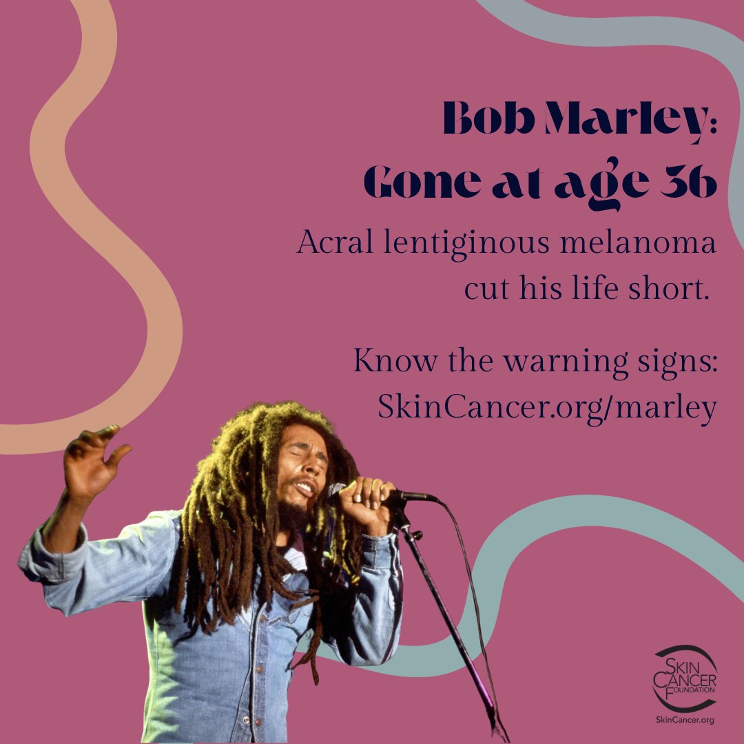 Today, Bob Marley would have been 80 years old. When a dark spot appeared under his toenail, Marley attributed it to a soccer injury. However, the spot under his nail was acral lentiginous melanoma (ALM), a rare, aggressive form of skin cancer. SkinCancer.org/marley.