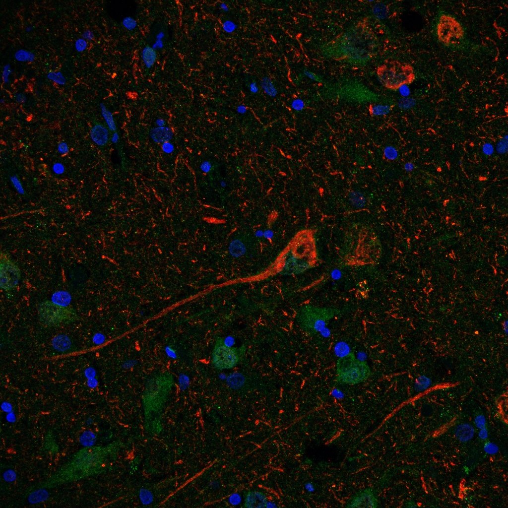 Vaya nivel tienen nuestros usuarios! 🔬
"Neurona cometa, pide un deseo"🪄
Autora: Isabel Lastres <a href="/Isalabe13/">I. Lastres-Becker lab 🧫🧬🔬</a> 
#ConcursoSEMOC #Microscopía <a href="/IIBmCSICUAM/">IIBM</a>