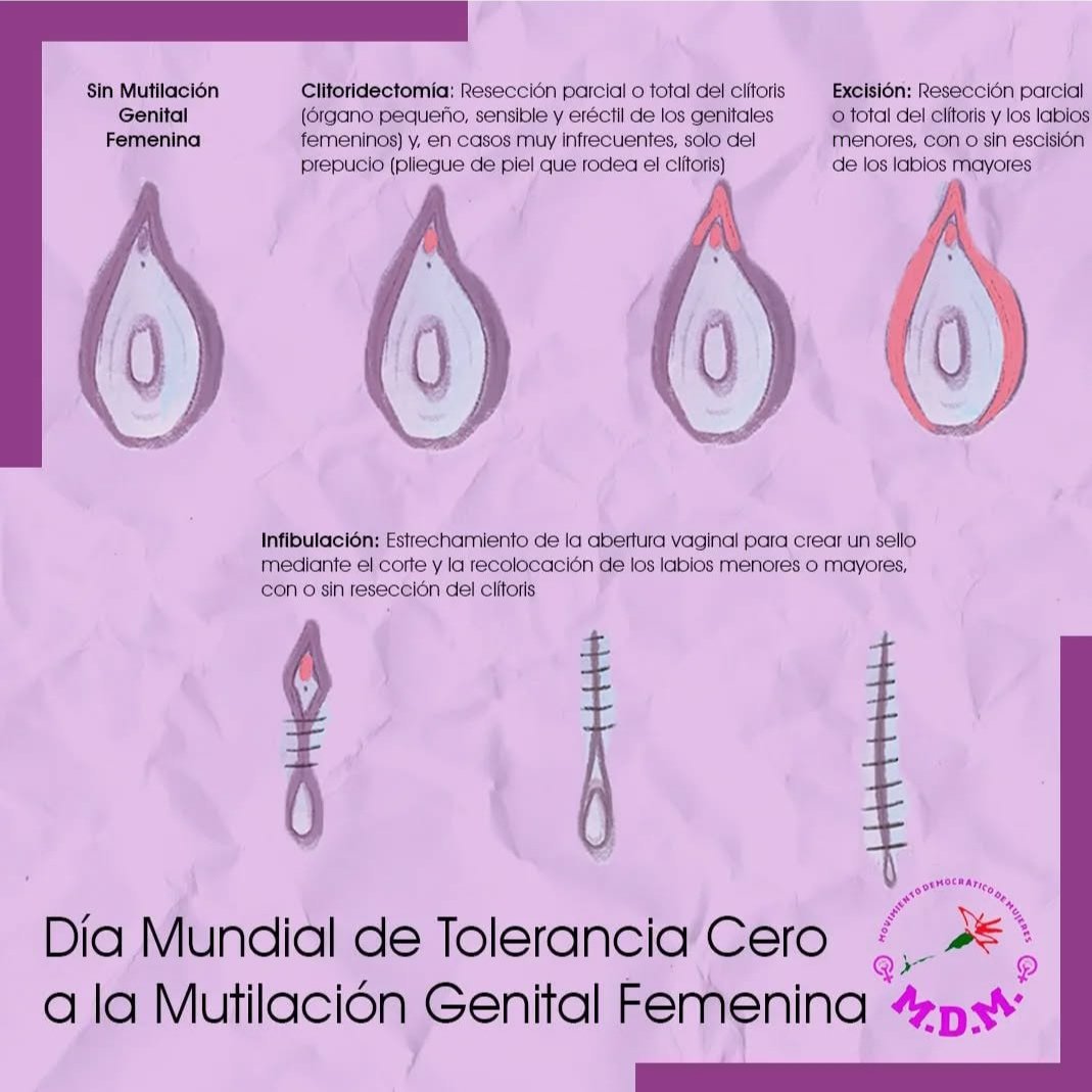 Día Mundial de Tolerancia Cero a la Mutilación Genital Femenina

#stopmutilación