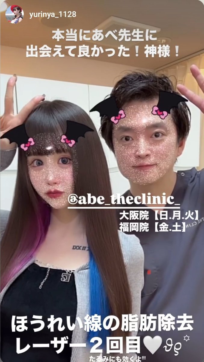 theclinic_abe's tweet photo. 第9回モフィウスプレゼント✨🎁✨
今週も「モフィウスフェイスライン」を無料プレゼント！
フェイスラインのもたつきが気になるけど、糸は異物だしフェイスリフトは怖い。
そんな方にモフィウスです😊
応募はアカウントフォローしてから、リポスト、いいねお願いします✨️
当選発表は１１日正午です😎 https://t.co/fPpWHDE62r
