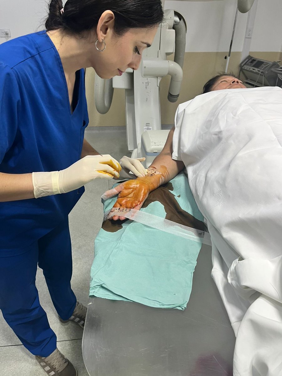 Norberto Bornancini (@cardiobornan) on Twitter photo Un día eres R1 y al siguiente sos R2 haciendo tu primera #radialfirst
🫶 <a href="/dra_maya/">Dra Mariana Maya</a>
#Residencia #SomosSantaClaraTalar
#Cardiology Un día eres R1 y al siguiente sos R2 haciendo tu primera #radialfirst
🫶 <a href="/dra_maya/">Dra Mariana Maya</a>
#Residencia #SomosSantaClaraTalar
#Cardiology