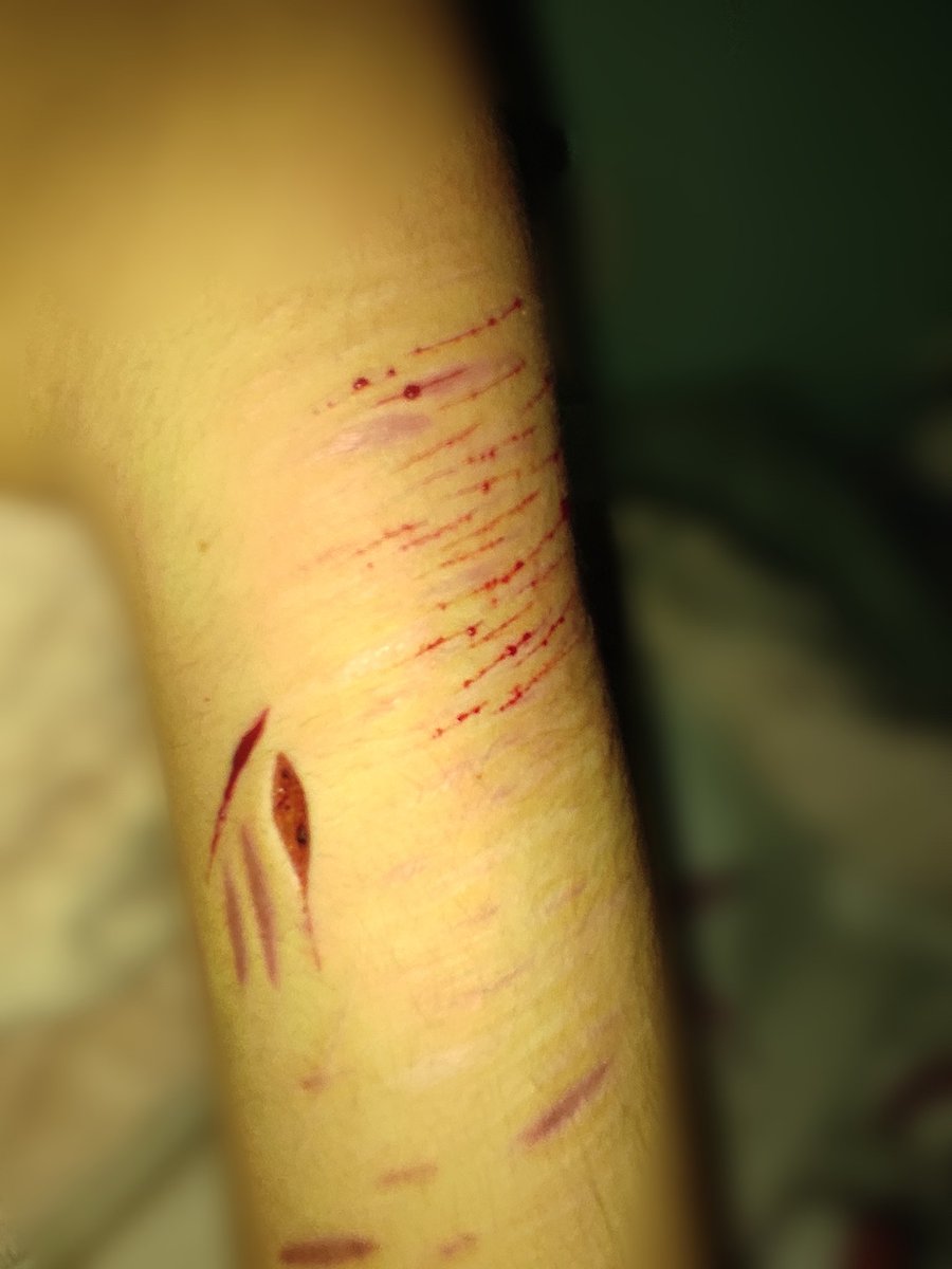 SE ME VE SÚPER DELGADO EL BRAZO(〃∀〃)ゞ