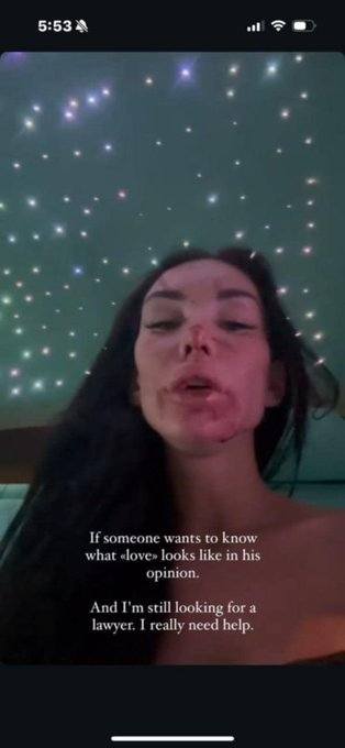 stockswami's tweet photo. WTF! 
Is this the ♥️of a cunt's life?
The girl needs help
https://t.co/cBGKL7vmHM https://t.co/muydEZM5YH