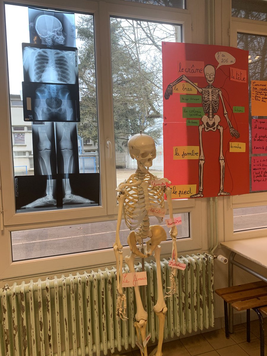 Dell’unto Sandrine (@dellsandrine) on Twitter photo Exposition sur le corps 🦶👁️🦷👃👄🧠
Un projet transversal, éducatif et fédérateur à l’école Jules Ferry #blois4
➡️ Lexique, Sciences, production d’écrit, arts plastiques… 👏👏Bravo aux élèves et à leurs enseignants !
<a href="/Fl_Barranco/">Fleurette Barranco, IEN Blois IV</a> <a href="/drinette41/">sandrine</a> <a href="/dsden41/">DSDEN de Loir-et-Cher - Académie d'Orléans-Tours</a> Exposition sur le corps 🦶👁️🦷👃👄🧠
Un projet transversal, éducatif et fédérateur à l’école Jules Ferry #blois4
➡️ Lexique, Sciences, production d’écrit, arts plastiques… 👏👏Bravo aux élèves et à leurs enseignants !
<a href="/Fl_Barranco/">Fleurette Barranco, IEN Blois IV</a> <a href="/drinette41/">sandrine</a> <a href="/dsden41/">DSDEN de Loir-et-Cher - Académie d'Orléans-Tours</a>