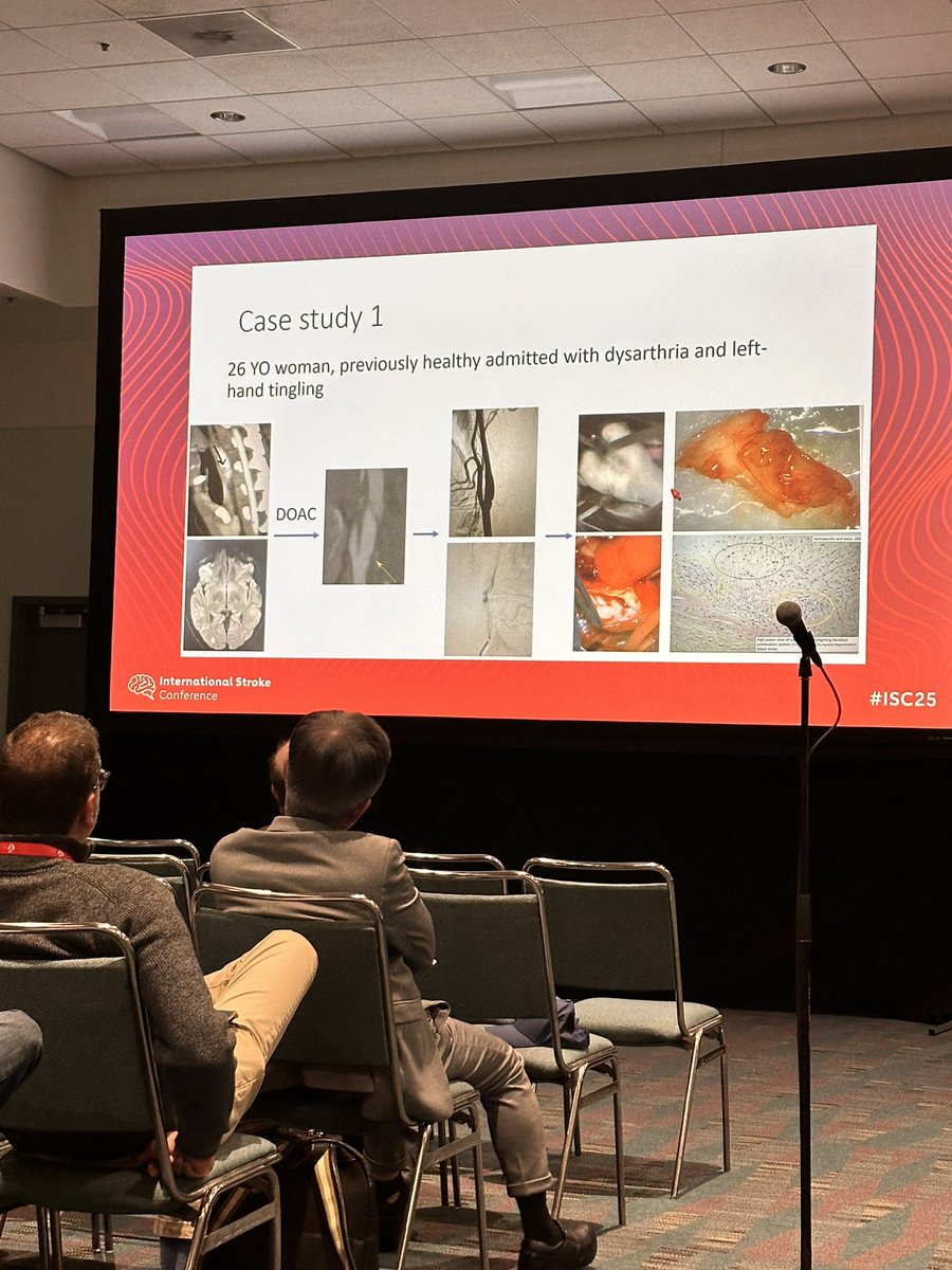DrKarenOrjuela's tweet image. Now at #ISC25: hot topics on hot carotids! 🔥🔥🔥 with @JimSiegler, Dr Singh and @ShadiYaghi2 @StrokeAHA_ASA @AHAScience @UChicago_Neuro