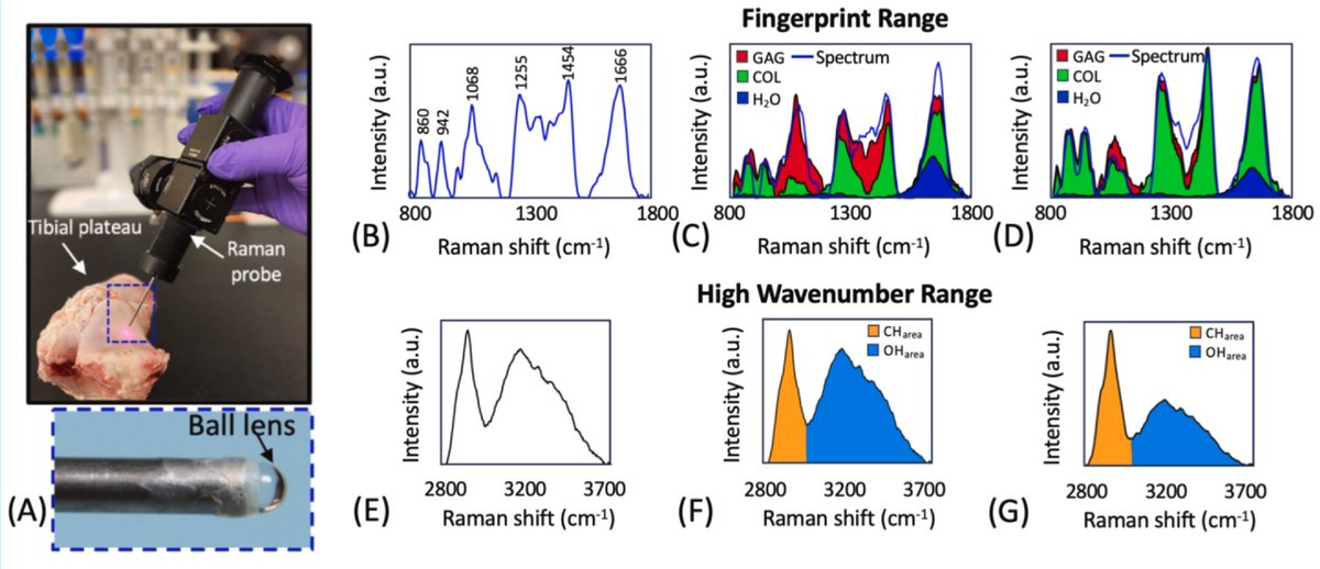 AlbroLab (@albrolab) on Twitter photo We are delighted to have our latest work on our arthroscopic Raman probe published in <a href="/OACJournal/">Osteoarthritis and Cartilage Journals</a>. Congrats to Massie Kazemi and the Raman team!
Check it out here: sciencedirect.com/science/articl⦠We are delighted to have our latest work on our arthroscopic Raman probe published in <a href="/OACJournal/">Osteoarthritis and Cartilage Journals</a>. Congrats to Massie Kazemi and the Raman team!
Check it out here: sciencedirect.com/science/articlā¦
