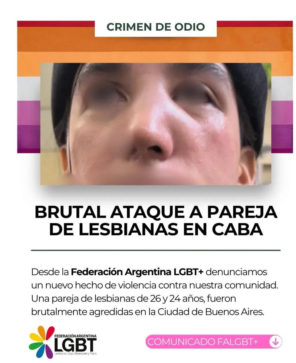 Una pareja de lesbianas de 24 y 26 años iba caminando por Ciudad de Buenos Aires, un hombre las para y les pregunta por qué están vestidas como varones y las termina golpeando. A una le fracturó la nariz, le rompió un diente y a la otra le lastimó la mano. Lo denuncia la <a href="/FALGBT/">Federación Argentina LGBT+</a>.