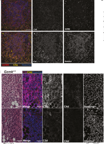 Waggoner Lab (@labwaggoner) on Twitter photo Granzyme K activates the entire complement cascade
nature.com/articles/s4158…
<a href="/Nature/">nature</a> <a href="/theis182/">Erin Theisen, MD, PhD</a> <a href="/AHelenaJonsson1/">A. Helena Jonsson</a> Granzyme K activates the entire complement cascade
nature.com/articles/s4158…
<a href="/Nature/">nature</a> <a href="/theis182/">Erin Theisen, MD, PhD</a> <a href="/AHelenaJonsson1/">A. Helena Jonsson</a>