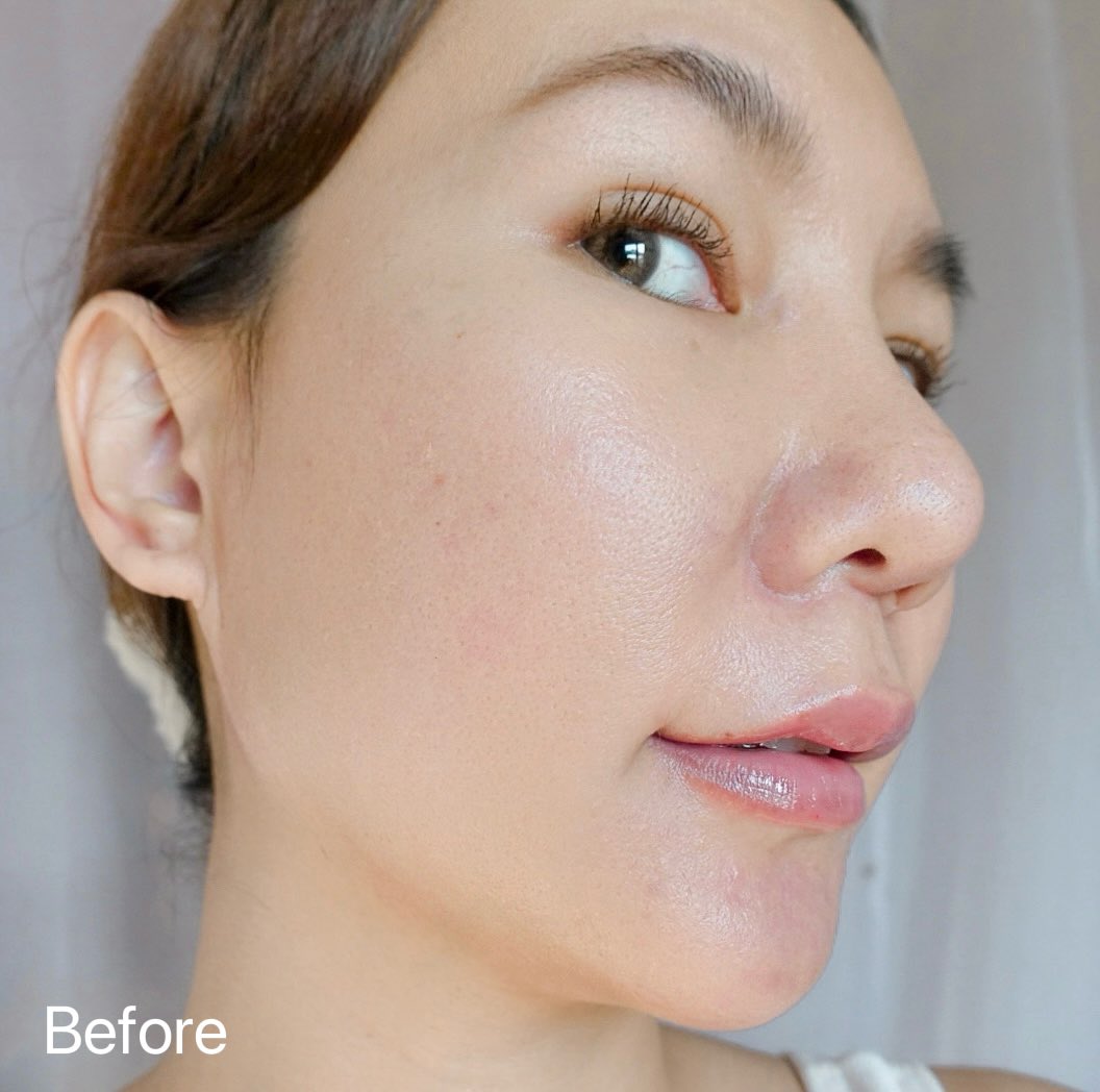 sabaisri's tweet photo. 📢 พลิก!! ประวัติศาสตร์วงการสกินแคร์สุดๆ กับเซรั่มตัวใหม่ Eucerin Epicelline® Serum ที่โคตรจะจิ้ง!!🤩 ขอบอกเลยว่าน่าลองสุดๆ ถือว่าเป็นปฏิวัติวิทยาศาตร์ครั้งยิ่งใหญ่เลยของ Eucerin ซึ่งเค้าพัฒนาเซรั่มนี้ ตาม Epigenetic Science🔬 จนค้นพบสาร Epicelline® ที่ช่วยเปิดสวิตซ์เซลล์ผิวอ่อนเยาว์ให้กลับมาทำงานอีกครั้ง จัดการปัญหาเรื่อง Anti-Age ถึงต้นตอ และได้นำมาช่วย support กลไกที่หลากหลาย🧬 ในการต้านความร่วงโรยของผิว
.
อีกทั้งยังช่วยจัดการ 10 สัญญาณแห่งวัยอีกด้วย ตัวเนื้อเซรั่มเป็นแบบสีขาว เนื้อบางเบา เกลี่ยง่าย ซึมไว หลังใช้ทันทีรู้สึกได้เลยว่าผิวฉ่ำ อิ่มฟู💦 ดูมีสุขภาพขึ้นเยอะ หากใช้เป็นประจำ จะช่วยทำให้ผิวดูอ่อนเยาว์ลง 5 ปี ใน 4 สัปดาห์ 🥰

#EucerinEpicellineSerum #เปิดสวิตช์ความอ่อนเยาว์ให้ผิว