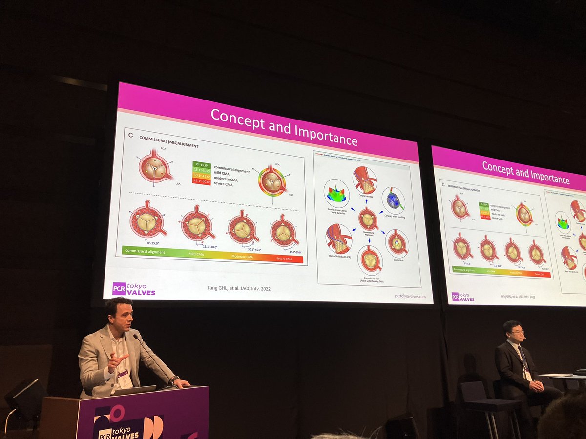 Yohei Turi Ohno (@ohnoturi) on Twitter photo Full house and great discussion! Thank you all for raising important clinical questions👍 #PCRTokyo <a href="/PCRonline/">PCRonline 🫀</a> <a href="/Miho_Fukui_/">Miho.Fukui</a> <a href="/misako_desu/">Misako TOKI</a> <a href="/TomokiOchiai/">Tomoki Ochiai</a> <a href="/drtsakamoto/">Tomohiro SAKAMOTO, MD, PhD</a> <a href="/Ravinay/">Ravinay Bhindi</a> <a href="/SimonCCLam/">Cheung-Chi Simon Lam</a> <a href="/GuiAttizzaniMD/">Gui Attizzani</a> <a href="/didier_tchetche/">Didier Tchetche</a> <a href="/dmylotte/">Darren Mylotte</a> Full house and great discussion! Thank you all for raising important clinical questions👍 #PCRTokyo <a href="/PCRonline/">PCRonline 🫀</a> <a href="/Miho_Fukui_/">Miho.Fukui</a> <a href="/misako_desu/">Misako TOKI</a> <a href="/TomokiOchiai/">Tomoki Ochiai</a> <a href="/drtsakamoto/">Tomohiro SAKAMOTO, MD, PhD</a> <a href="/Ravinay/">Ravinay Bhindi</a> <a href="/SimonCCLam/">Cheung-Chi Simon Lam</a> <a href="/GuiAttizzaniMD/">Gui Attizzani</a> <a href="/didier_tchetche/">Didier Tchetche</a> <a href="/dmylotte/">Darren Mylotte</a>