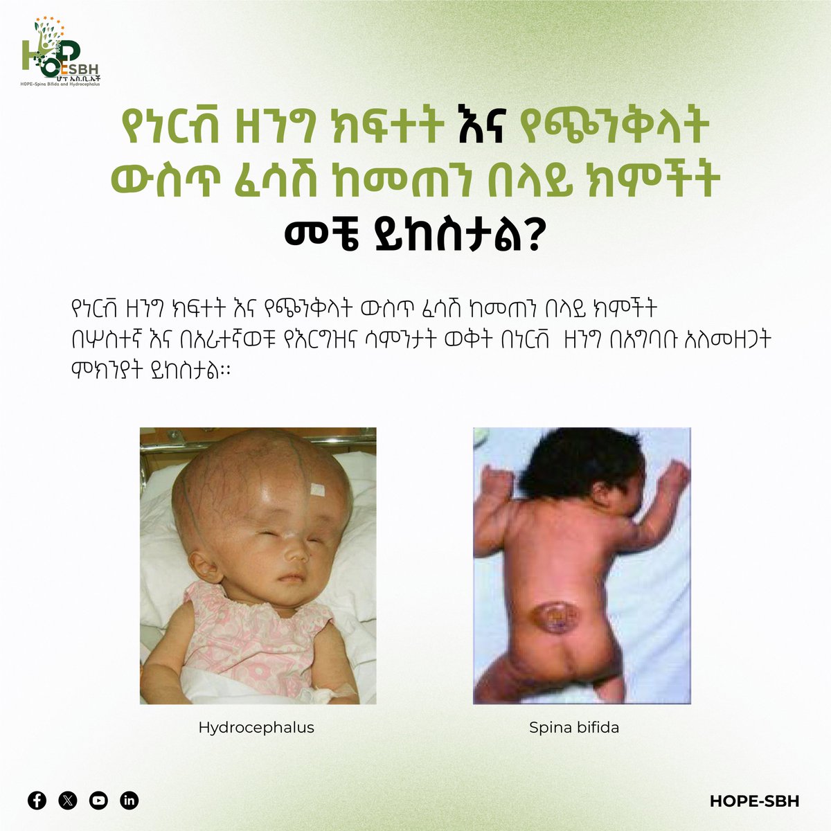 HOPEsbh's tweet photo. #HOPR #MOH #MoWSA #PMO #OFLEthiopia #MoI #BMGF #UNICEF #GAIN #NI #IFglobal #CHI #fhi360 #AddisGuzo #HOPESBH #SpinaBifidaHydrocephalusAwarenes #FolicAcid #MaternalHealth #SpinaBifida #Hydrocephalus #Advocacy #CommunityHealth #InclusiveSociety #BehavioralChange #RAF #Ethiopia #EBS https://t.co/WZi8A6tX9L