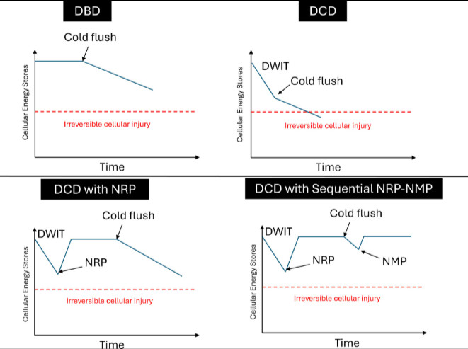 The present study demonstrates lower rates of ischemic cholangiopathy and improved graft survival with NRP alone or NRP + NMP compared with SCS when using #liver grafts from DCD donors. #LiverTransplant <a href="/ShennenMao/">Shennen Mao, MD</a> <a href="/aqel_bashar/">Bashar Aqel</a> <a href="/MathurAmitK/">Amit K. Mathur, MD MS FACS</a> <a href="/KrisCroome/">KrisCroome</a> bit.ly/415zrzc