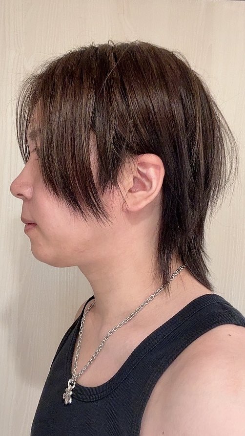 jin_623_'s tweet photo. 〜ダウンタイム6ヶ月経過〜

遂に半年経過して輪郭が割と出てきた！
向く角度によっては二重顎になるけど…
両顎手術したら仕方ないって聞くしそこはやっぱりリフトアップとか考えないとなのかな🤔
まだまだこれからが楽しみ！

#id美容外科 #韓国整形 #骨切り
#両顎手術 #Vライン形成
#ルフォー #ssro https://t.co/n9nZUu19Y0