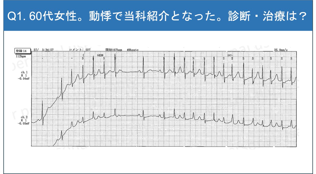 jiro_ecg's tweet photo. Q1　どうぞ！ https://t.co/sF6QZXgokt