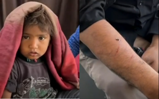 BenefitNews24's tweet image. અમરેલીમાં શ્વાનના હુમલાઓથી લોકોમાં ભારે ભયનો માહોલ

વિગતે વાંચો :
benefitnews.in/gujarati/gujar…

#Amrelicity #dogattacks #fear #children #women #CCTV