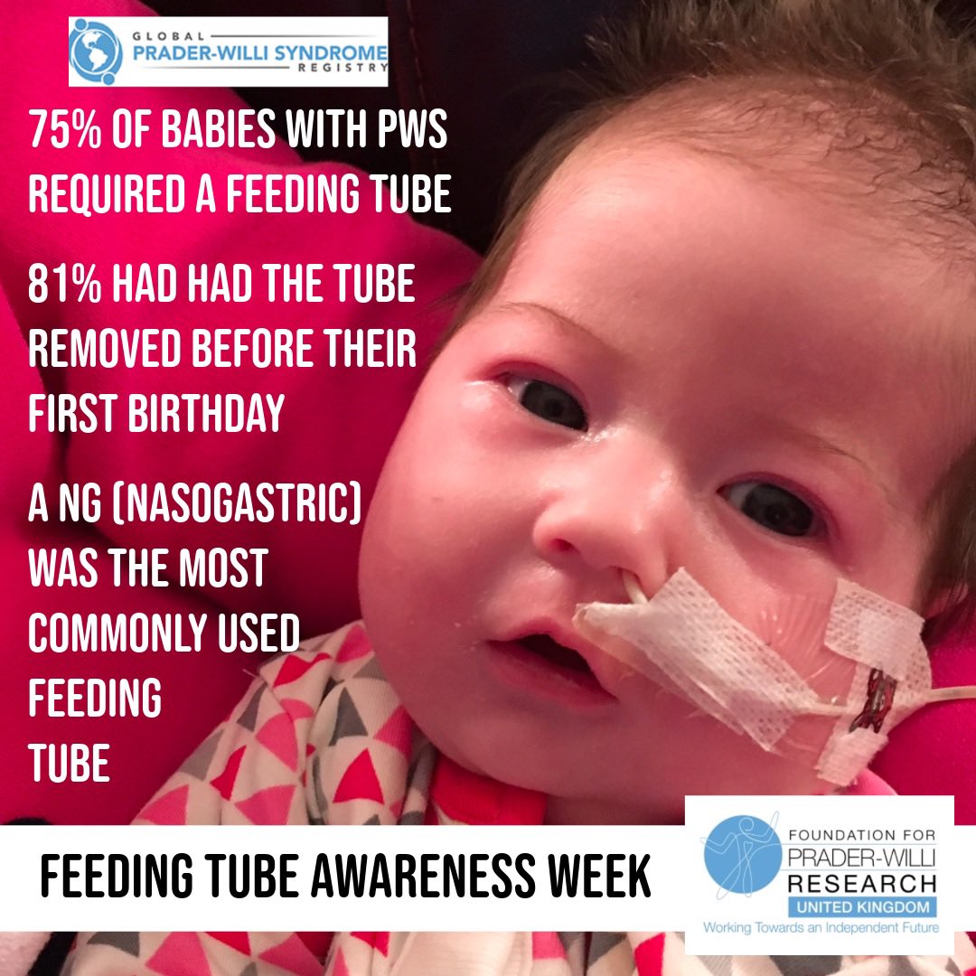 This week is Feeding Tube Awareness Week. 
Many babies with PWS require feeding support when they are born due to a weak and uncoordinated suck making breast and bottle feeding too difficult. 
#fpwruk #pws #praderwillisyndrome #feedingtube #feedingtubeawarenessweek