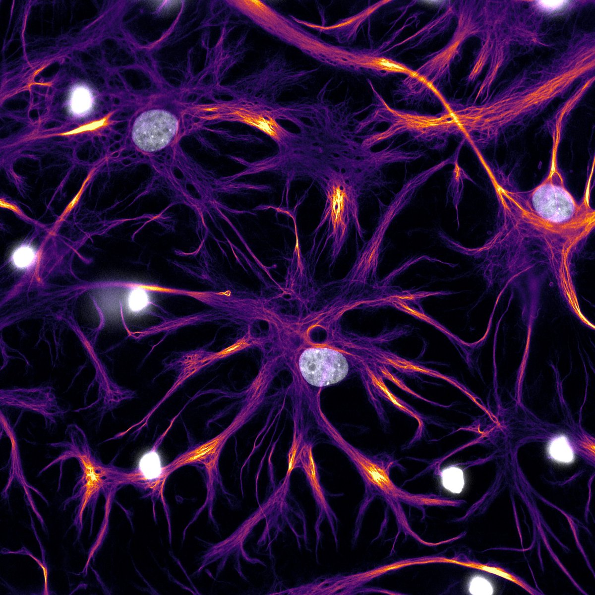 When science meets art: moons among cosmic rays 🌌

Astrocytes labeled with anti-GFAP sd antibody from <a href="/_NanoTag_/">NanoTag</a> , with cellular nuclei glowing under Hoechst staining

#FluorescenceFriday #Science #Art
