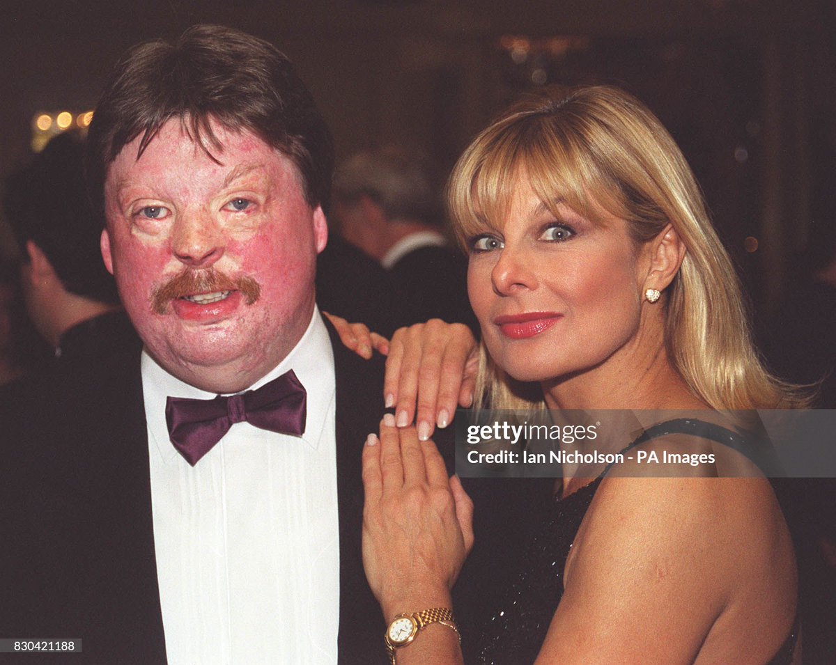 Falklands Hero Simon Weston OBE is joined by former model Jily Johnson at the "Weston Spirit' charity gala at the Cafe Royal in London (1998)
