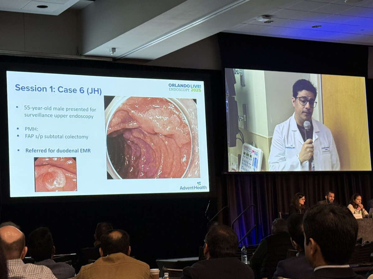 MN_GIMD's tweet image. Finally made it to #OLE2025 Day 2 @AdventHealthCFL 

Session 1 Live Demonstrations w/ an all star panel moderating &amp;amp; phenomenal endoscopists at play @DrHasan_Orlando @BilalMohammadMD @SChandanMD @JessWidmer3 @ReemSharaiha @DennisYangMD @MuzaffarAkbar #UzmaSiddiqui…