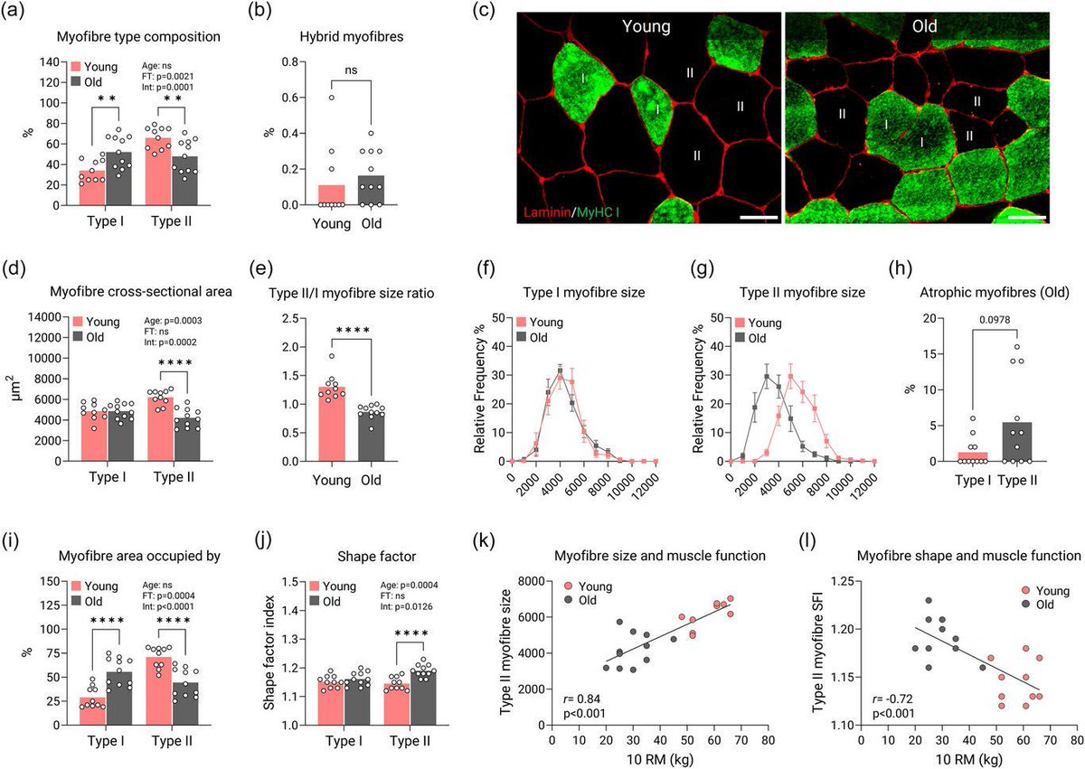 Experimental Physiology (@expphysiol) on Twitter photo How does ageing impact type I and type II myofibre properties in human muscle? <a href="/HorwathOscar/">Oscar Horwath, PhD</a>, <a href="/MobergPhD/">Marcus Moberg, PhD</a>, <a href="/SebastianEdman/">Sebastian Edman</a>, <a href="/WiApro/">William Apró, PhD</a> (<a href="/gihsweden/">gihsweden</a>) and <a href="/andyphilp_lab/">Andrew Philp</a> (<a href="/CentenaryInst/">Centenary Institute</a>) investigate.
📜buff.ly/40tFBJG How does ageing impact type I and type II myofibre properties in human muscle? <a href="/HorwathOscar/">Oscar Horwath, PhD</a>, <a href="/MobergPhD/">Marcus Moberg, PhD</a>, <a href="/SebastianEdman/">Sebastian Edman</a>, <a href="/WiApro/">William Apró, PhD</a> (<a href="/gihsweden/">gihsweden</a>) and <a href="/andyphilp_lab/">Andrew Philp</a> (<a href="/CentenaryInst/">Centenary Institute</a>) investigate.
📜buff.ly/40tFBJG