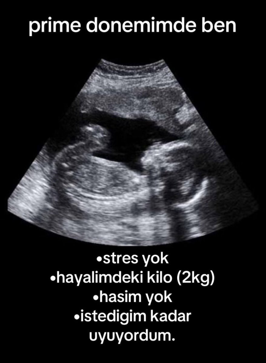 su de (@artikbidur) on Twitter photo 