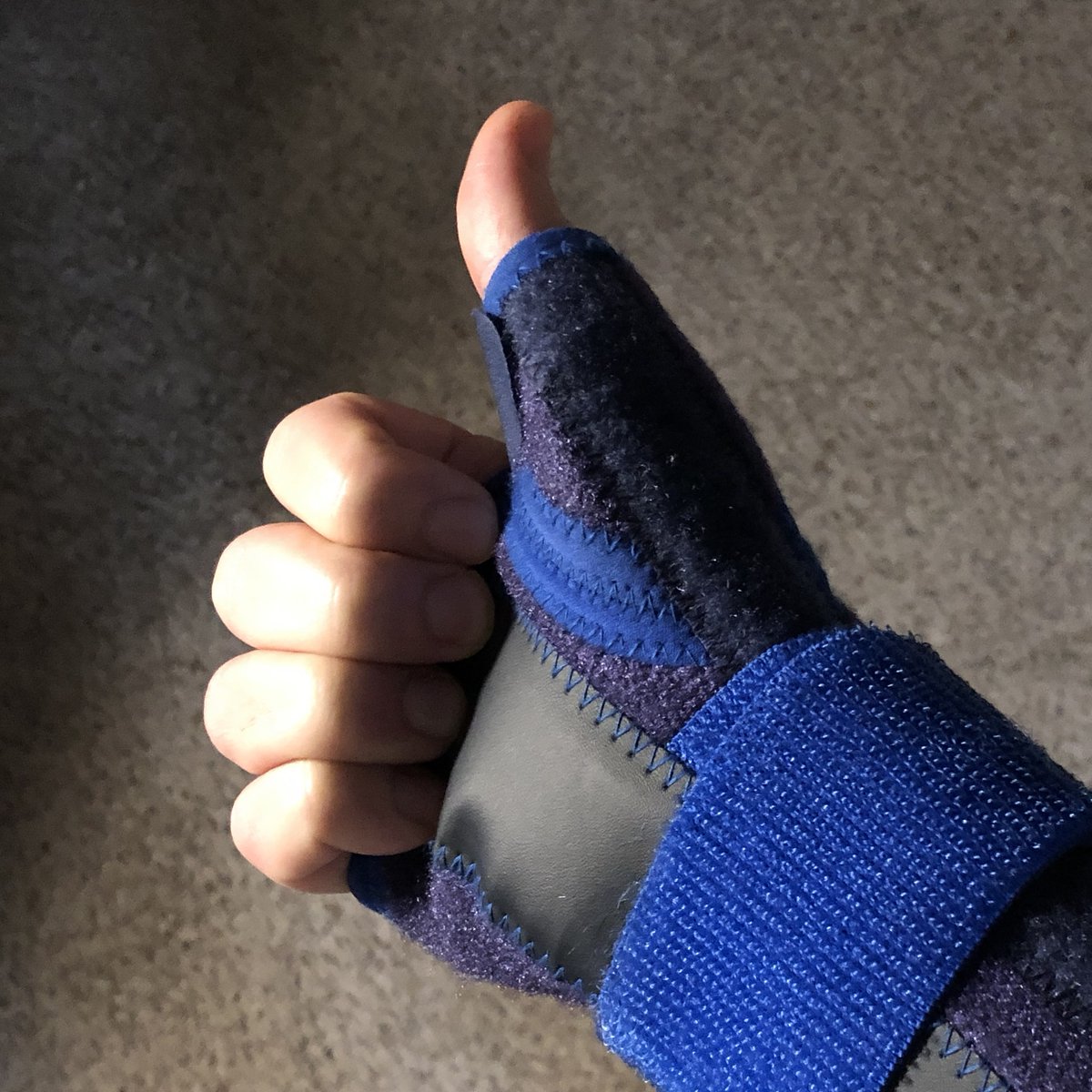 BdoubleO100's tweet image. "WHERE'S BDUBS!?"
I am ashamed to admit that I have sustained 2 injuries from sitting in a chair playing Minecraft.
One is just a recurring shoulder injury that I can remedy with some PT.
The other is commonly called "Mommy Thumbs." Imagine a lightning bolt striking the base…