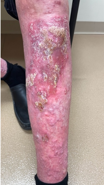 Mehdi Hamadani, MD tweet media