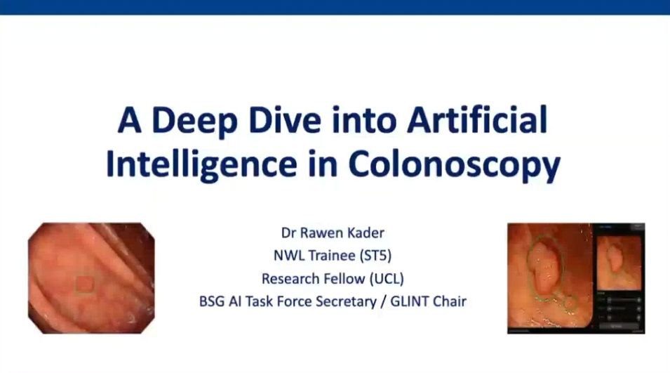 Fantastic <a href="/StMarksHospital/">St Mark's Hospital</a> Grand Round presentation delivered this morning by <a href="/RawenKader/">Rawen Kader</a> who took us on a deep dive into AI in colonoscopy. Really interesting discussion about the human-AI interaction and real life implementation of AI in clinical practice