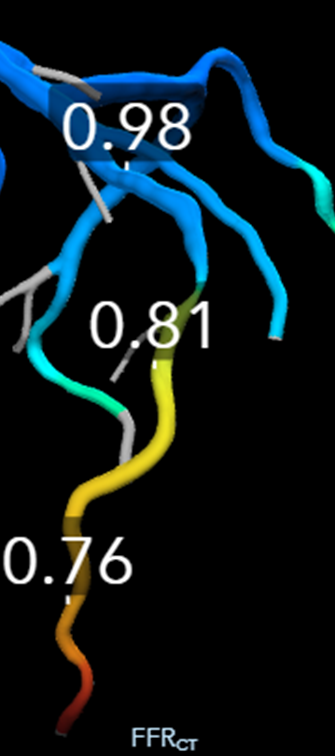 Tom Hyde tweet media