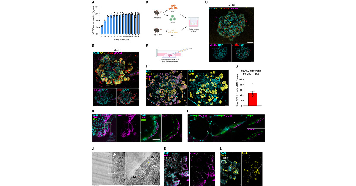 ATS Red Journal (@ajrcmb) on Twitter photo Endothelialized Bronchioalveolar Lung Organoids Model Endothelial Cell Responses to Injury
<a href="/anaivonneva/">Ana Ivonne Vazquez-Armendariz</a> <a href="/atscommunity/">American Thoracic Society (ATS)</a>
🔗 tinyurl.com/7j4yf7cm Endothelialized Bronchioalveolar Lung Organoids Model Endothelial Cell Responses to Injury
<a href="/anaivonneva/">Ana Ivonne Vazquez-Armendariz</a> <a href="/atscommunity/">American Thoracic Society (ATS)</a>
🔗 tinyurl.com/7j4yf7cm