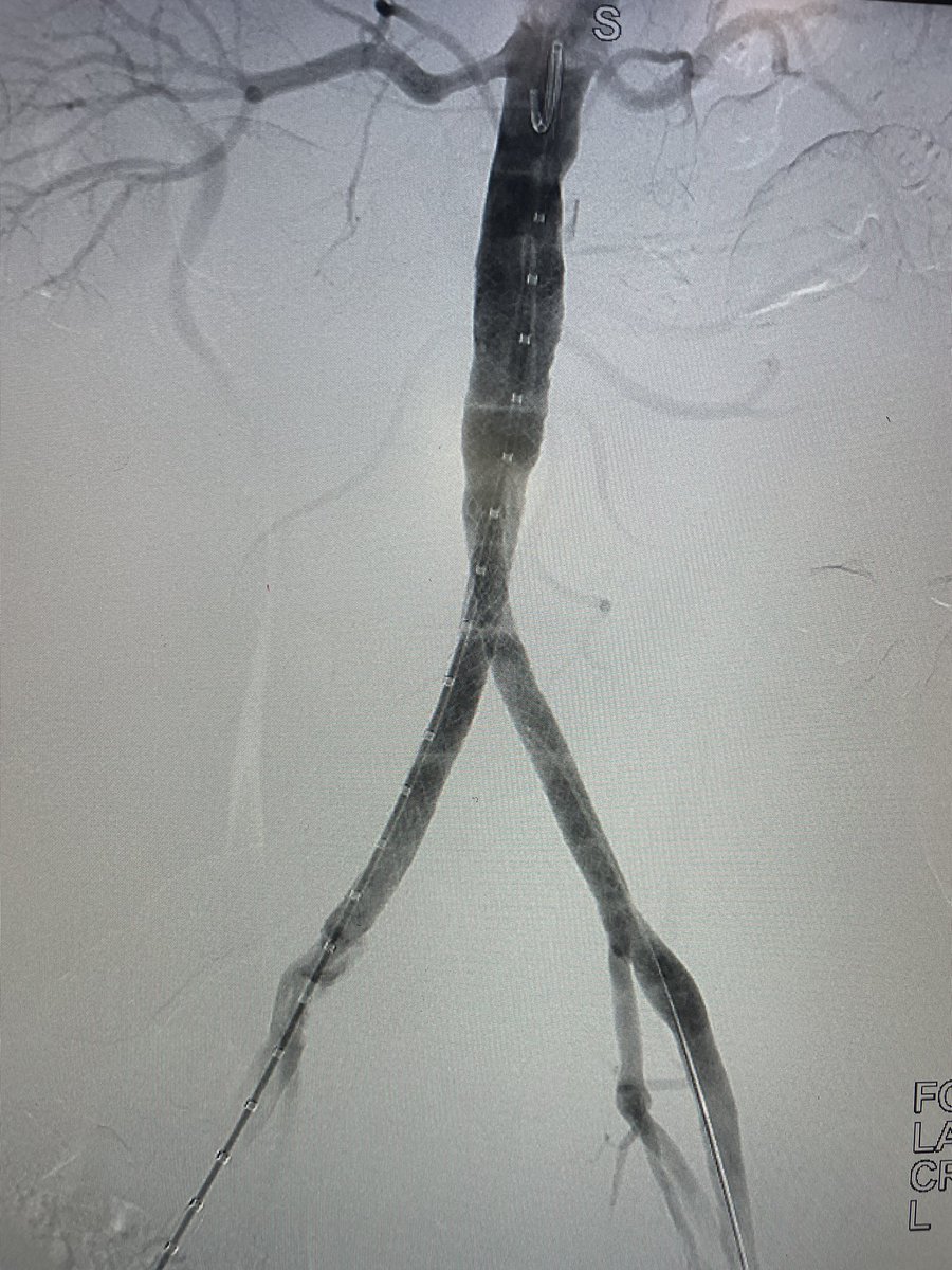 yuejianing's tweet photo. a typical CERAB for AIOD #CLTIFighter https://t.co/dZ9jYDPRvh