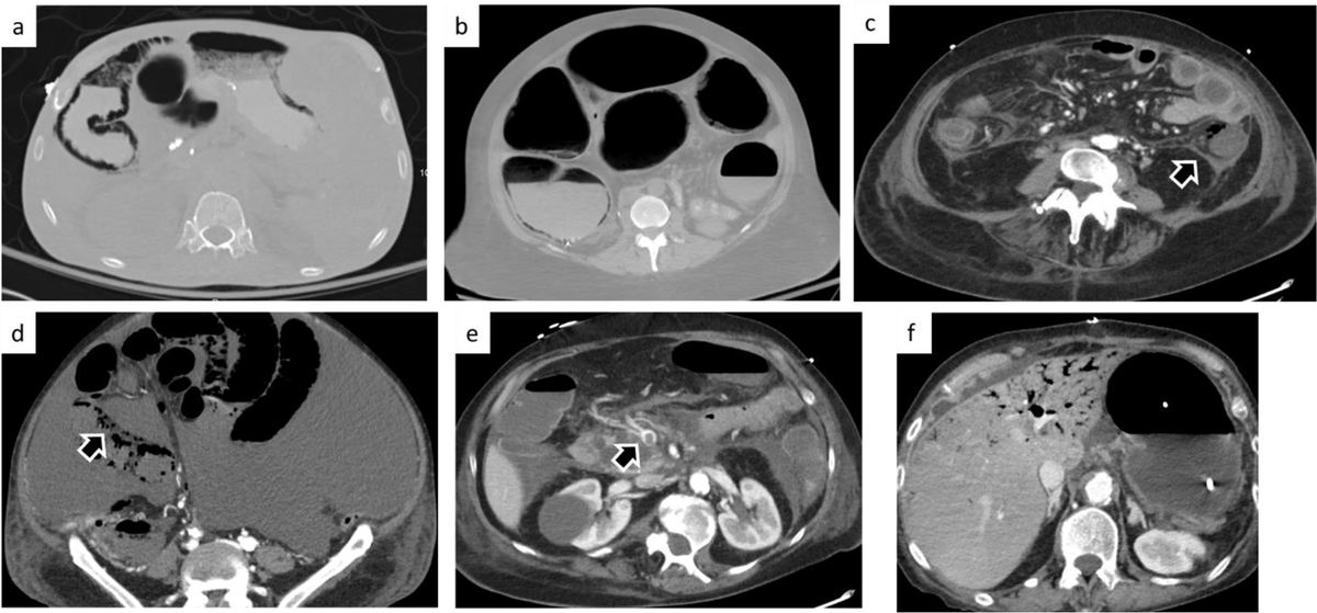 Olga R Brook, MD, FSAR, FSIR, FSABI, FESGAR (@olgabrook) on Twitter photo 