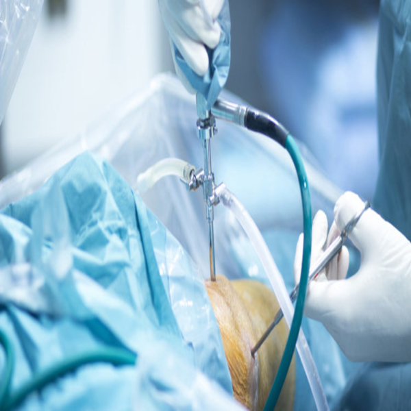 CapricornFMNews's tweet photo. A 14-year-old from Sekgosese village outside Botlokwa's self-esteem has been restored after spending his teenage life being mocked by his peers over a leaking throat allegedly from a #botchedsurgery.
The boy who cannot be named as he is a minor, was admitted at Kgapane hospital in 2015 where he underwent surgery due to a swelling neck, but it resulted in his neck leaking when drinking liquids.
The Conty Lebepe Foundation brought a ray of hope after they escalated the matter to Health Minister Dr Aaron Motsoaledi for intervention and the boy was eventually admitted to Steve Biko Academic Hospital in Pretoria for an operation. OK