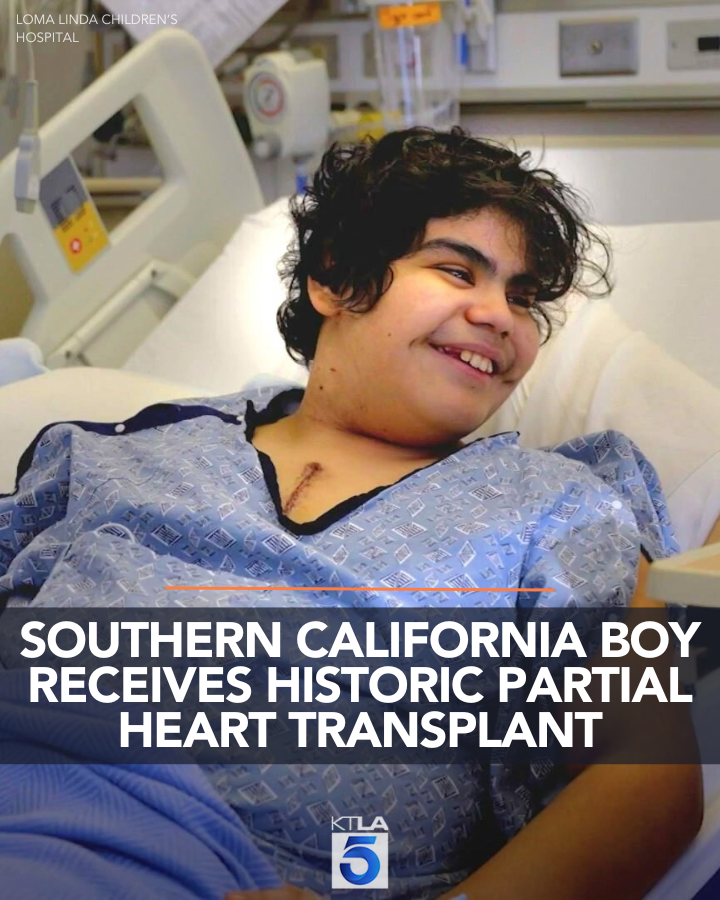 KTLA's tweet photo. History was made after a team of surgeons successfully performed a pediatric partial heart transplant in Southern California for the first time.
Details: https://t.co/0TrIqv9OBy https://t.co/2KVhZJQ08F