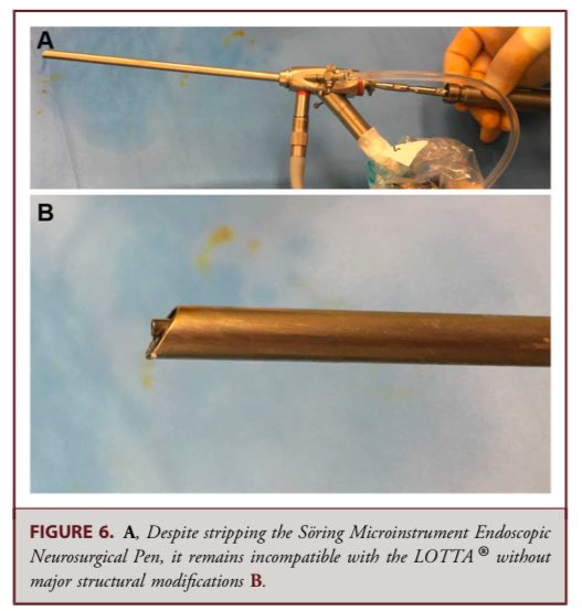 King's Neurosurgery (@kingsneuro) on Twitter photo Publication alert!
We have published largest series in use of ultrasonic aspirator with its modifications for intraventricular pathologies in <a href="/NeurosurgeryCNS/">Neurosurgery Publications</a>.
shorturl.at/tTFxS
👉 for resource limited settings
👉relevant for those centers with original instrument Publication alert!
We have published largest series in use of ultrasonic aspirator with its modifications for intraventricular pathologies in <a href="/NeurosurgeryCNS/">Neurosurgery Publications</a>.
shorturl.at/tTFxS
👉 for resource limited settings
👉relevant for those centers with original instrument