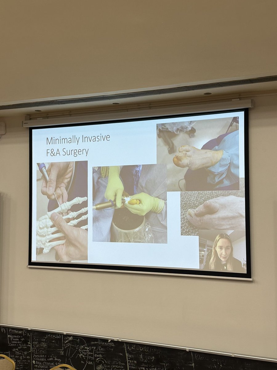 Grateful to <a href="/M2020Ni/">Evelyn Murphy</a> who opened todays #RCSICharter fascinating  virtual talk about on her time as the <a href="/RCSI_Irl/">RCSI</a> <a href="/Olympus_Corp/">Olympus</a> PROGRESS Fellow 2023. Amazing MIS work in foot &amp; ankle surgery! Heartening to see female orthopaedic trainees excelling around the world <a href="/AWSIreland/">AWS Ireland</a>