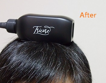 mukouchan4's tweet image. 洗髪後に使う「Tricore　温感ヘッドスパトリートメント　フルボトル（200ml）」
キャップいらずのノズルで頭皮に塗って、温感マッサージ☆
気持ち良い＆ほのかな香り。
美容室の発想で、しっかりケアします！

#PR
#tricore
#トリコレ
#温感生トリートメント
#トリコレでちゅるん髪
#韓国コスメ