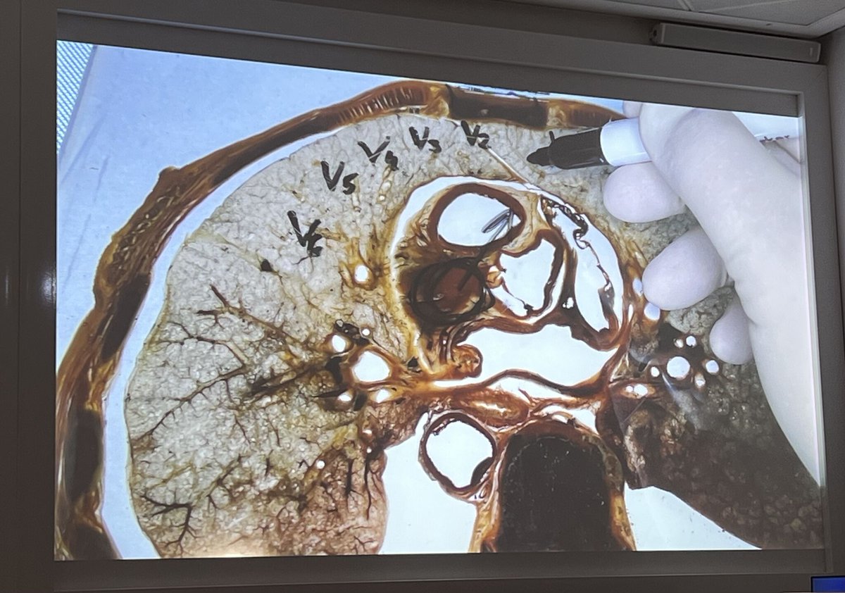👉 #Epeeps “Back to basics—learn electrophysiology,” as Prof. Mark Josephson urged in Electrophysiology at a Crossroad (2007). 

✅ Today, we continue to inspire #EPeeps to truly “go back to basics—learn electrophysiology”, focusing on its fundamental link with 🫀 #anatomy.

🤩