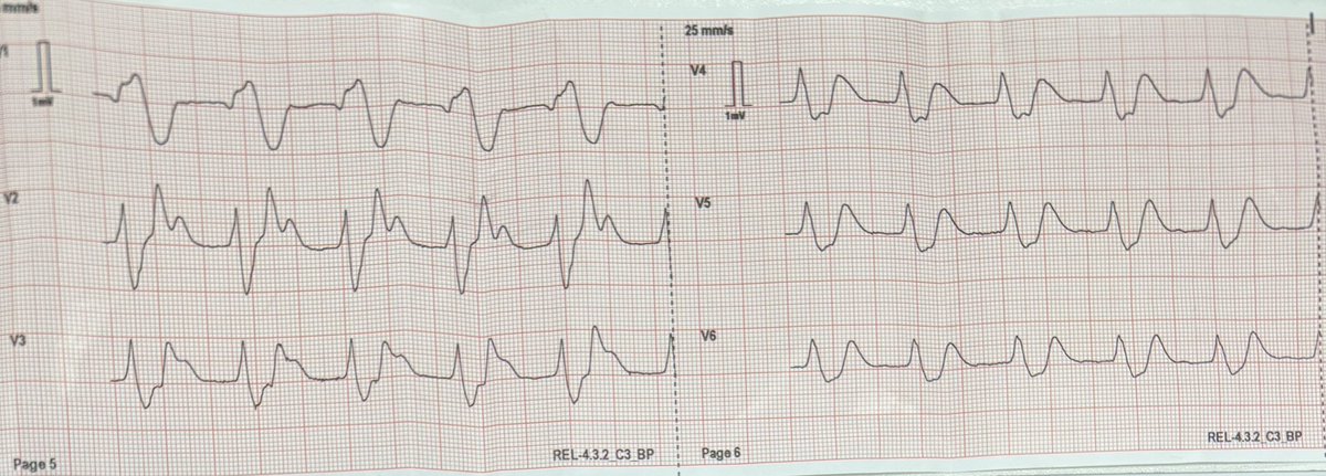 The ECG Educator 🩺 🫀 tweet media
