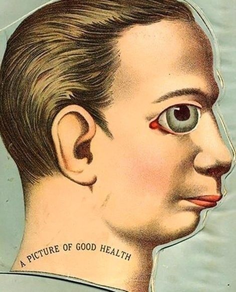 A picture of good health.