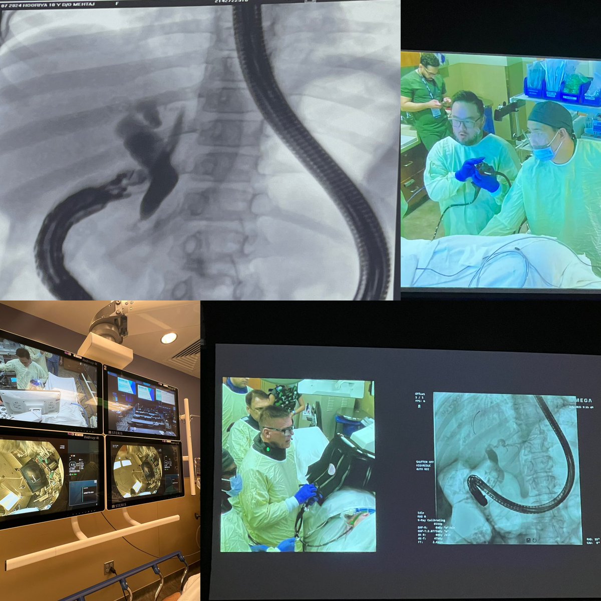 #OLE2025 wraps up after 3️⃣ fantastic days of advanced endoscopy immersion—🔥 45+ complex cases!

Just as Disney World is a must for kids, CIE Orlando is a dream destination for endoscopy lovers. The magic here is unmatched - you have to experience it!

Huge 🙏 to the team #CIE