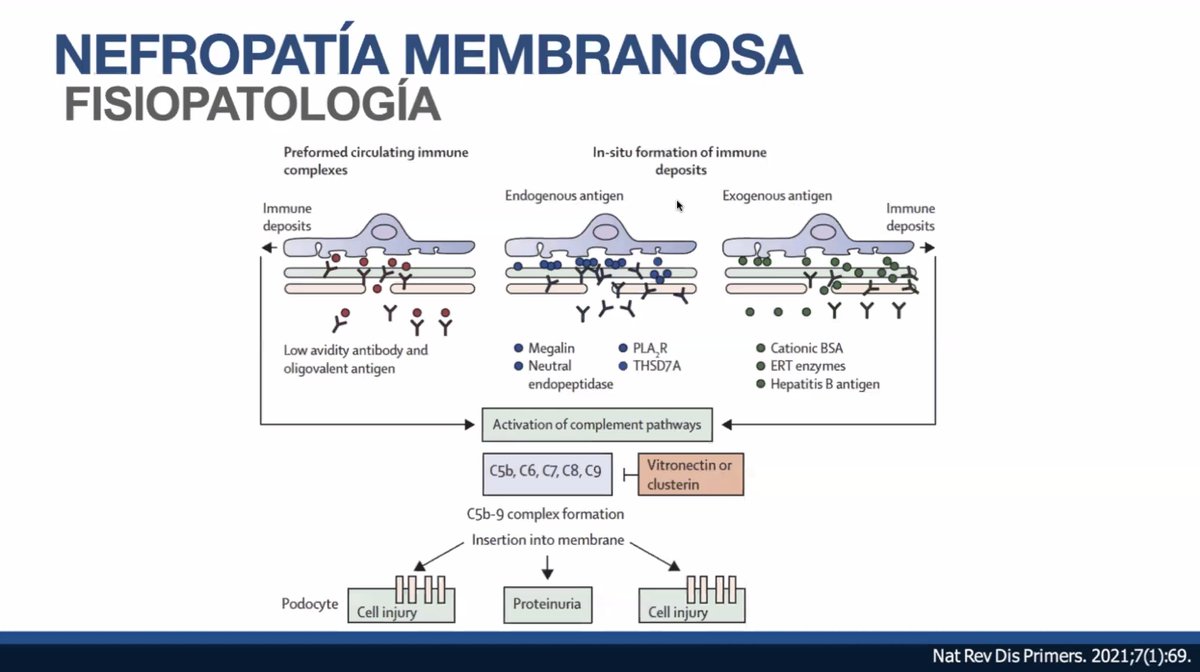 ⏰🚨Sábados de Glom con ILA!!!🫘❣️.....Nefropatía membranosa una de las patologías más apasionantes y con gran avance fisiopatológico, la verdadera medicina de precisión , de la mano de <a href="/Mafer_ZavalaM/">MaFer Zavala</a>  <a href="/GlomConILA/">GlomCon Ibero-LatinoAmérica</a>