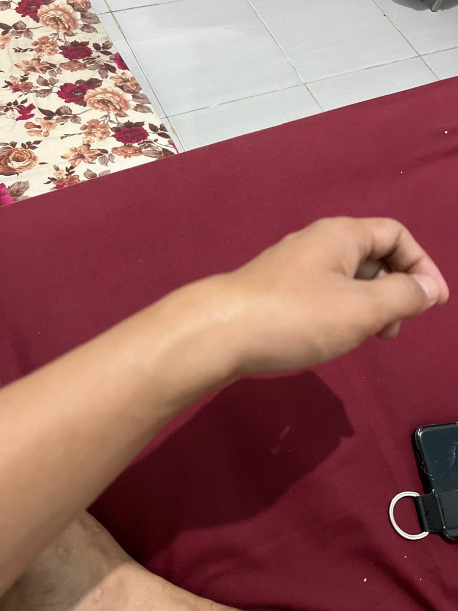 afiqazah's tweet photo. Mas A ada” aja ya Allah, cepat sembuh yaa🥺😖💗 kamu jauh gini aku gabisa apa-apa. Sehat-sehat Aamiin ya Allah https://t.co/mFCVLv5hRq