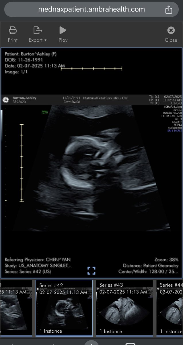 Poochieb2691's tweet photo. My boy 7/2025💙🩵 #18Weeks https://t.co/tPNVsSwcjm
