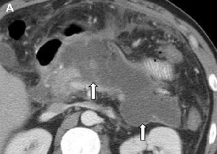 Giovanni Marchegiani tweet media